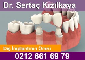 implant ömrü ne kadar?